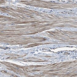 GPR161 Antibody, Novus Biologicals:Antibodies:Primary Antibodies